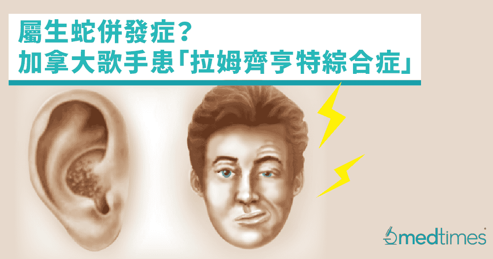 【带状疱疹】罕见病属生蛇并发症？加拿大歌手患「拉姆齐亨特综合症」致面瘫